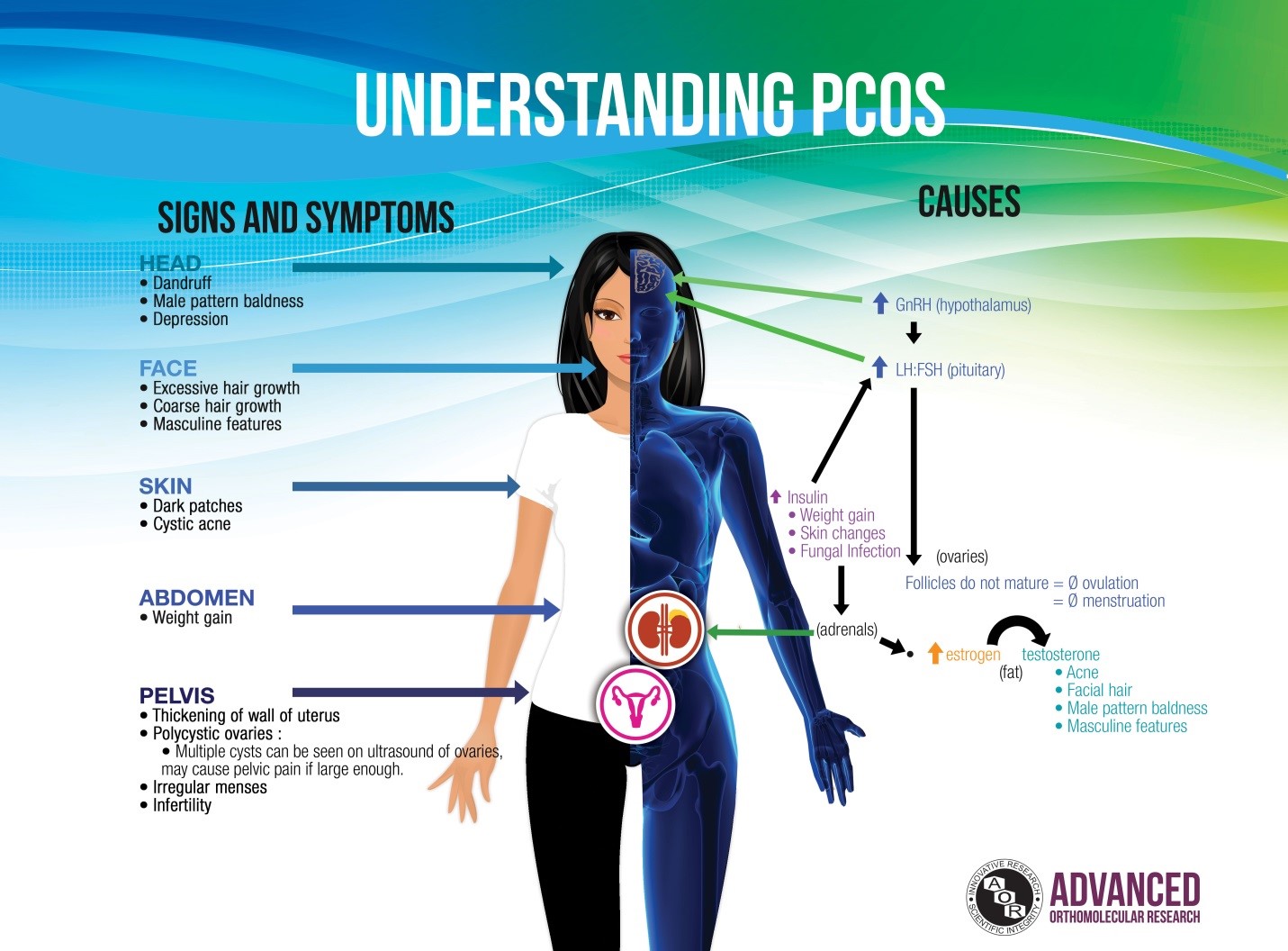 Acupuncture And Polycystic Ovarian Syndrome PCOS Meridian Acupuncture